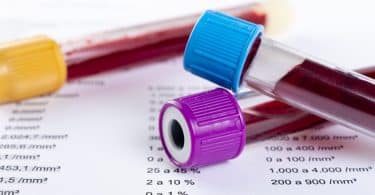 Laboconnect : comment consulter ses résultats d’examen ?